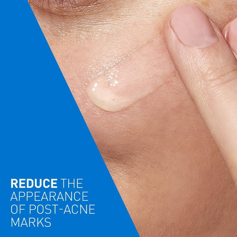 Blemish Control Resurfacing Retinol Serum 30Ml, for Blackheads, Blocked Pores, Dark Spots & Blemish-Prone Skin, Encapsulated Retinol + Niacinamide + Licorice Root Extract + Ceramides