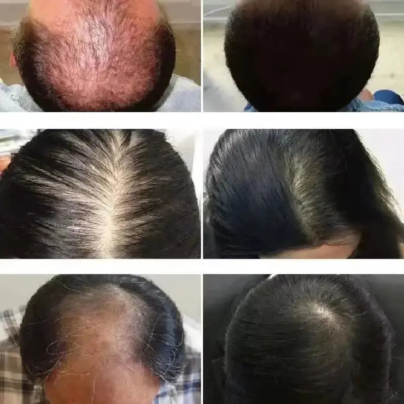 Hair Growth Essential Oil Rosemary Hair Serum Capsule Oil anti Hair Loss Baldness Repair Damaged Scalp Treatment for Women Men