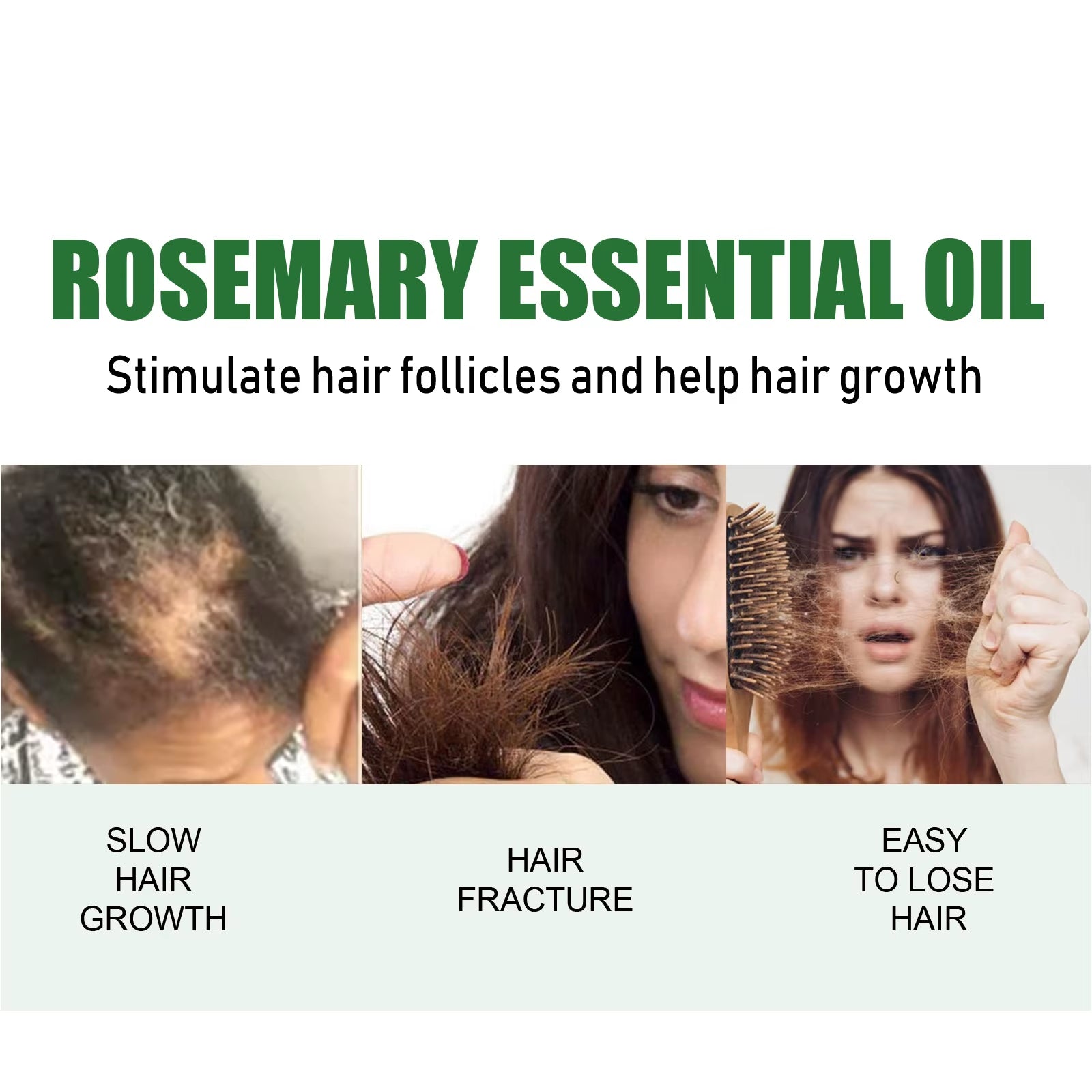 Rosemary Oil for Hair Growth Stimulate Follicle Oily Scalp Treatment Repair Dry Damaged Rough Removal Soothing Improve Loss Oil