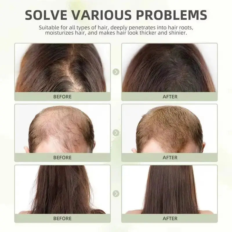 Hair Growth Essential Oil Rosemary Hair Serum Capsule Oil anti Hair Loss Baldness Repair Damaged Scalp Treatment for Women Men