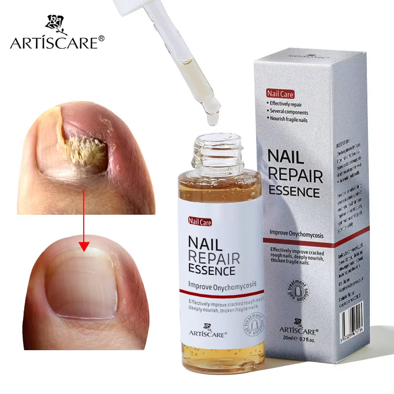 ARTISCARE Nail Care Essence Feet Care Nail Serum 20Ml